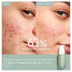 Caudalie Vinopure Blemish Control Salicylic Serum 30ml -René furterer Sale Store caudalie vinopure blemish p54905 g 3 fr.jpeg